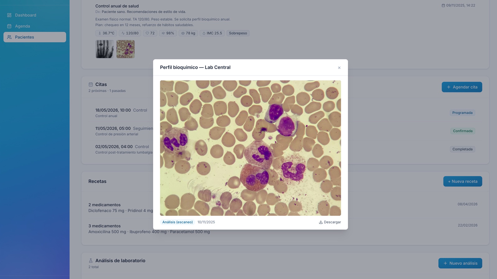 Ficha del paciente con lightbox — visor modal de imágenes médicas servidas por URL presignada desde MinIO, sobre la vista de signos vitales con flag automático ‘Sobrepeso’, citas, recetas y análisis